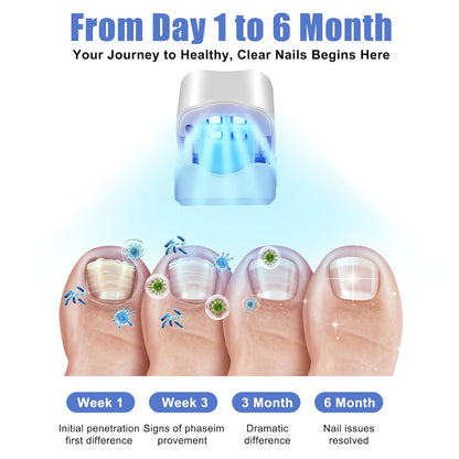 AVELVA dedal LED para hongos en uñas
